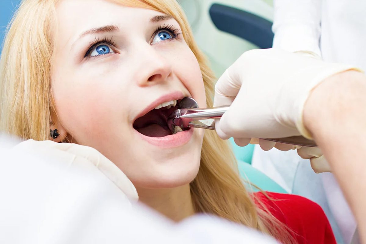 7 Tips Quick Recovery After Wisdom Tooth Extraction