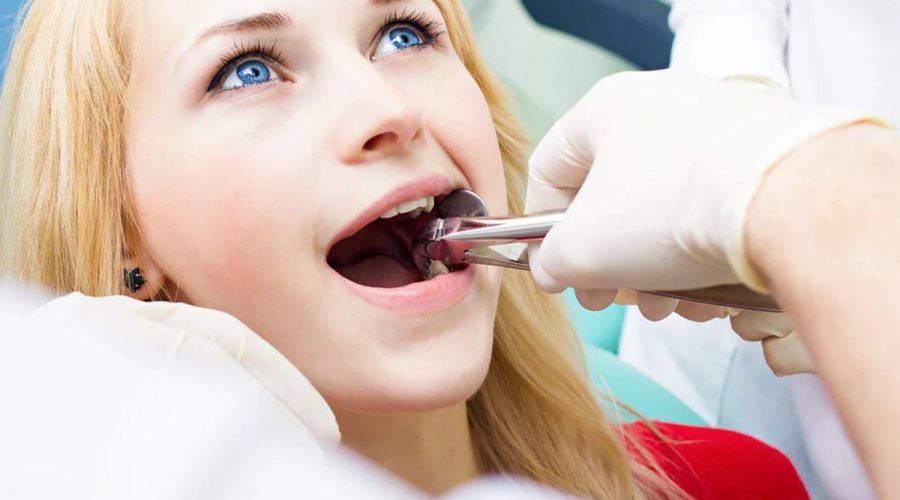 7 Tips Quick Recovery After Wisdom Tooth Extraction